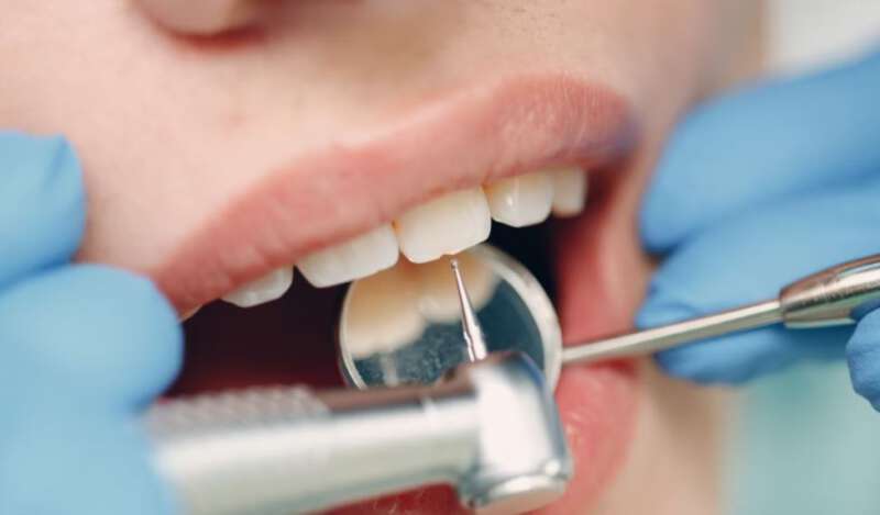 CHECK UP ORALE E IGIENE DENTALE PROFESSIONALE