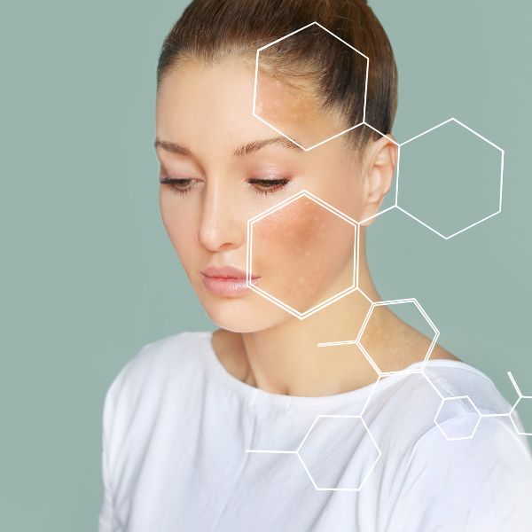 Pelle e sole: prevenzione e buone abitudini