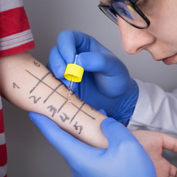 Allergologia: perché la prevenzione fa la differenza